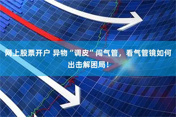 网上股票开户 异物“调皮”闯气管，看气管镜如何出击解困局！